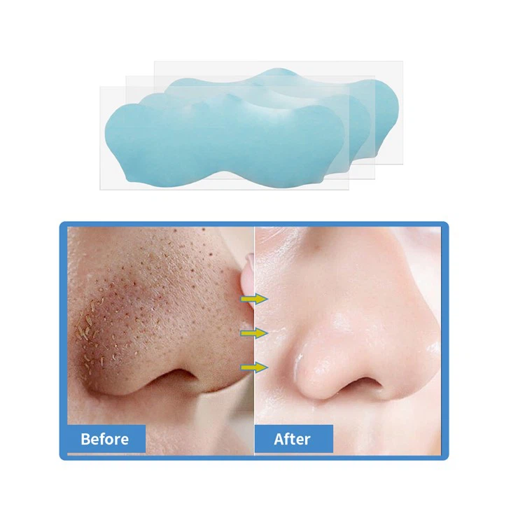 blackhead strips (10)